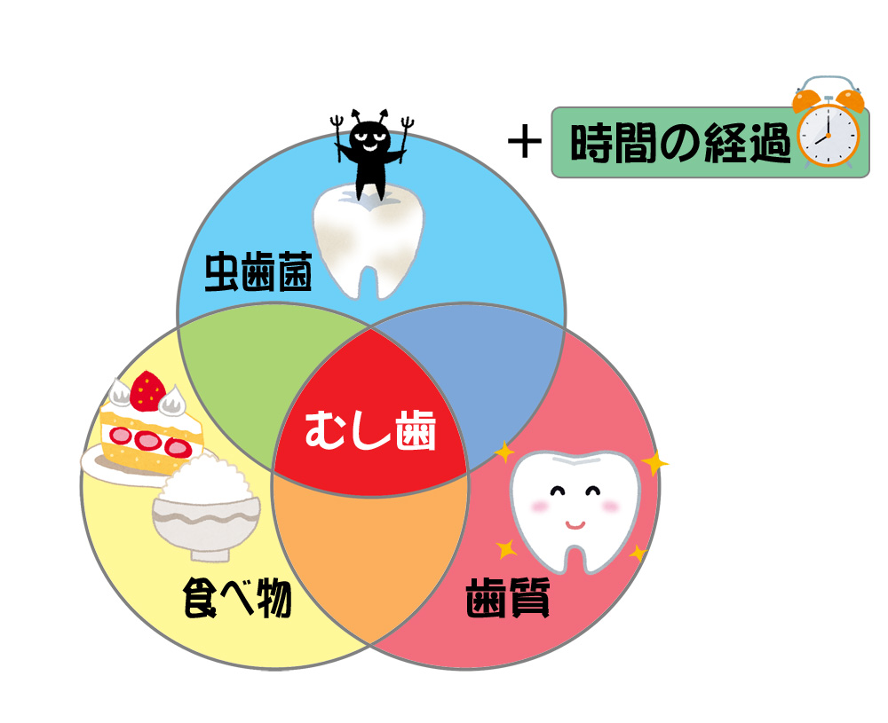 虫歯の原因